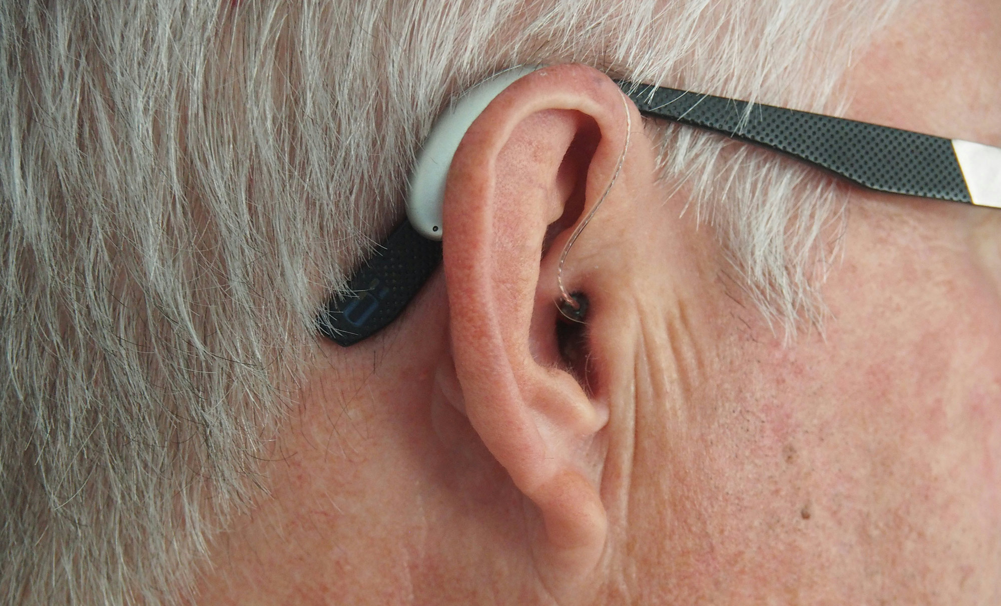 Evidence of Neurocognitive Benefit From Hearing Aid Use